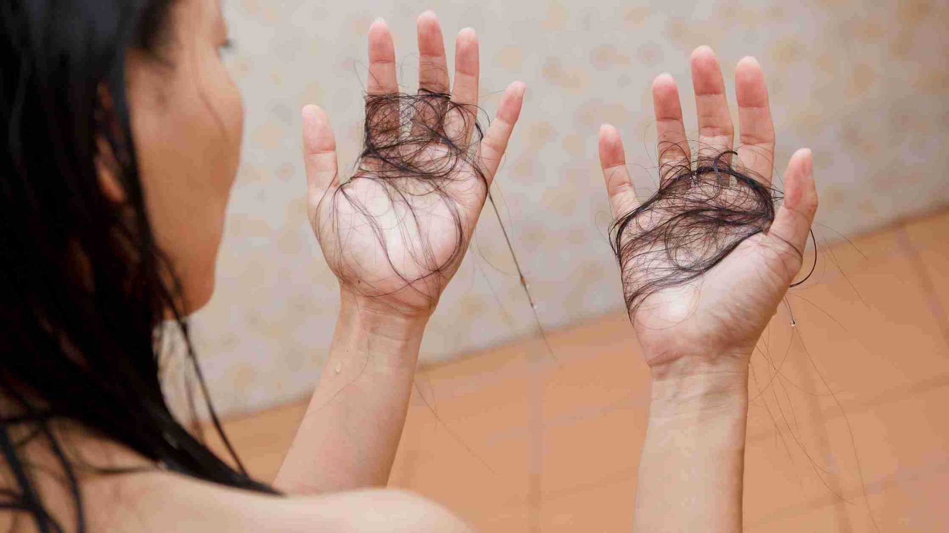 Rambut Rontok Berlebihan? Begini 7 Cara Mengatasinya!